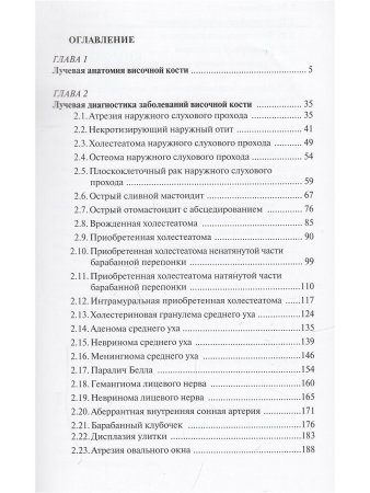 Лучевая диагностика заболеваний и повреждений височной кости