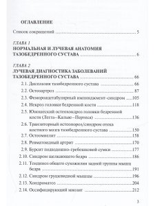 Лучевая диагностика заболеваний и повреждений тазобедренного сустава.