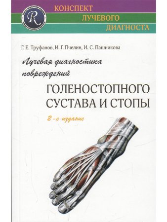 Лучевая диагностика повреждений голеностопного сустава
