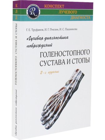 Лучевая диагностика повреждений голеностопного сустава
