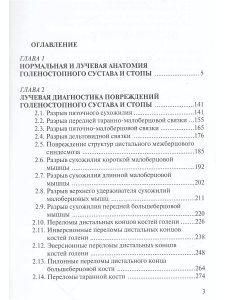 Лучевая диагностика повреждений голеностопного сустава