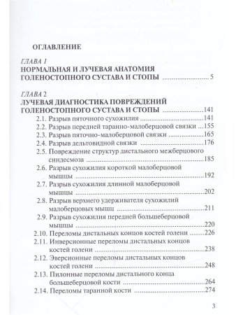 Лучевая диагностика повреждений голеностопного сустава