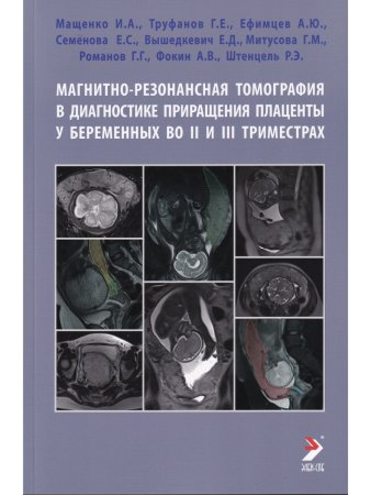 Магнитно-резонансная томография в диагностике приращения плаценты у беременных во II и III триместрах
