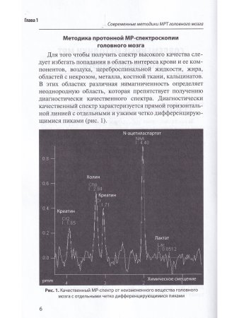 МРТ в диагностике неопухолевых заболеваний головного мозга