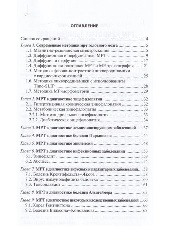 МРТ в диагностике неопухолевых заболеваний головного мозга