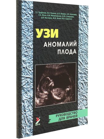 УЗИ аномалий плода. 2-е издание