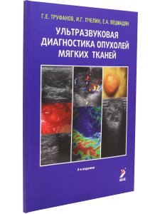 Ультразвуковая диагностика опухолей мягких