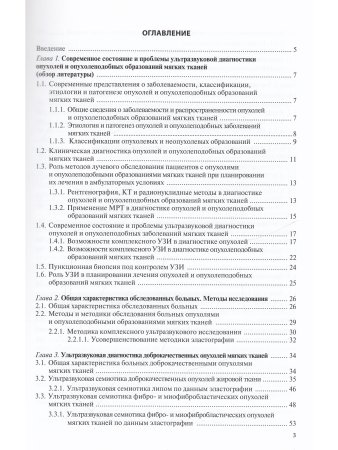 Ультразвуковая диагностика опухолей мягких