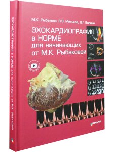 Эхокардиография в норме для начинающих от Рыбаковой