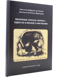 Венозные синусы черепа - один из ключей к мигреням