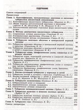 Внелёгочный туберкулёз т.2