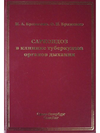 Саркоидоз в клинике туберкулеза органов дыхания