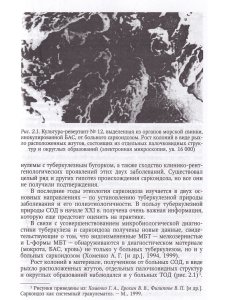 Саркоидоз в клинике туберкулеза органов дыхания