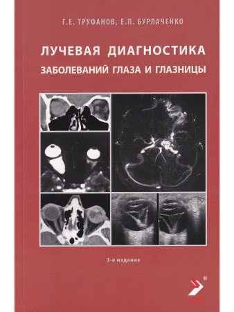 Лучевая диагностика заболеваний глаза и глазницы