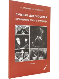Лучевая диагностика заболеваний глаза и глазницы