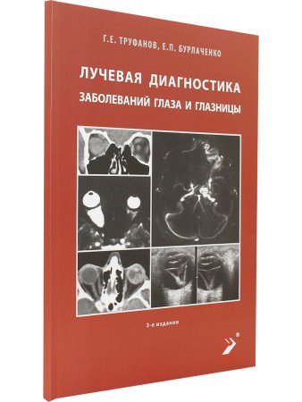 Лучевая диагностика заболеваний глаза и глазницы