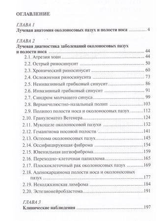 Лучевая диагностика заболеваний околоносовых пазух и полости носа. 4-е издание