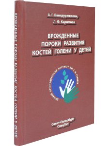 Врождённые пороки развития костей голени у детей