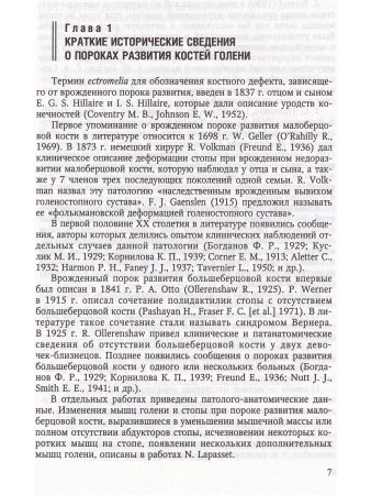 Врождённые пороки развития костей голени у детей