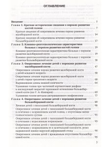 Врождённые пороки развития костей голени у детей