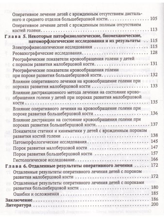 Врождённые пороки развития костей голени у детей
