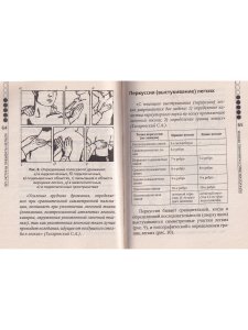 Внебольничная пневмония